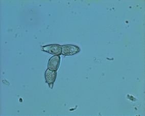 Teliospores of P. horiana