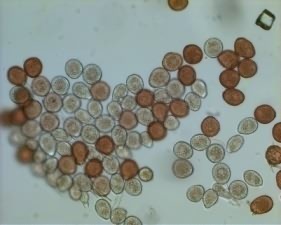 Uredospores of Puccinia chrysanthemi