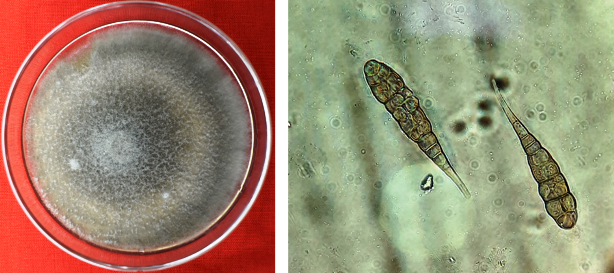 Colony and conidial morphology of Alternaria Porri